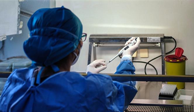 ABD’de Monkeypox virüsü alarmı: 200’den fazla temaslı izleniyor