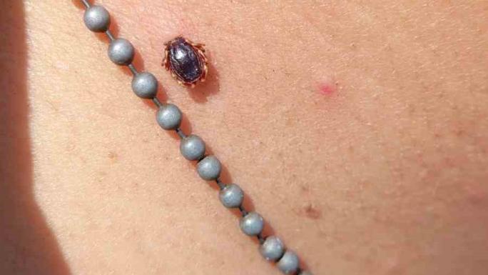 BALIK TUTMAYA GİTTİ, BOYNUNA KENE YAPIŞTI 