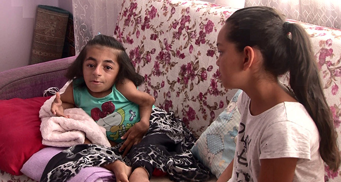 Cam kemik hastası Nazar, tedavi için yardım bekliyor