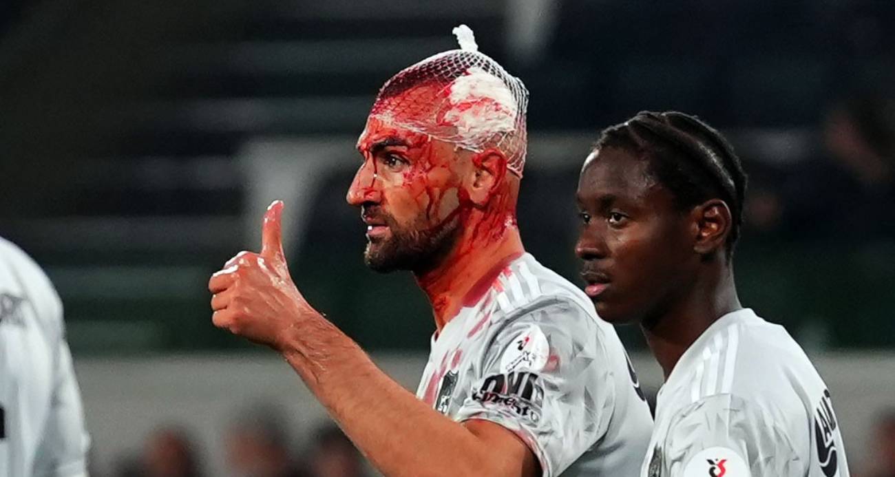 SERDAR DURSUN VE JEROME OPOKU HAVA TOPU MÜCADELESİNDE ÇARPIŞTI 