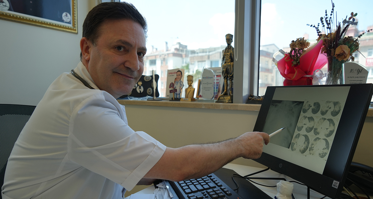 PROFESÖR AÇIKLADI: &QUOT;HANTAVİRÜS, KEMİRGENLERDEN BULAŞIYOR&QUOT; 