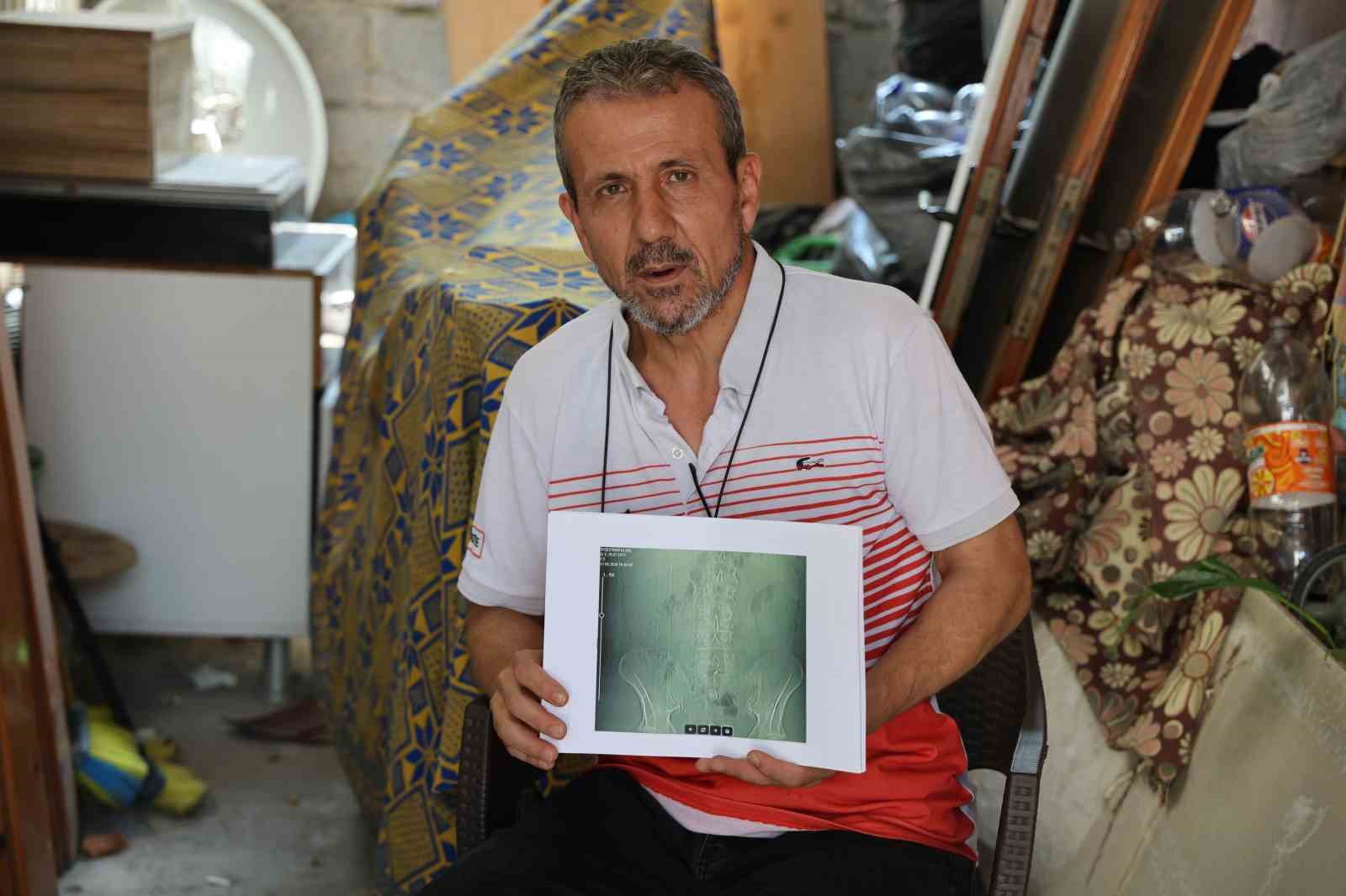 İŞ KAZASI GEÇİRDİ, AMELİYAT OLDU, BELİNDE PANÇ UNUTULDU