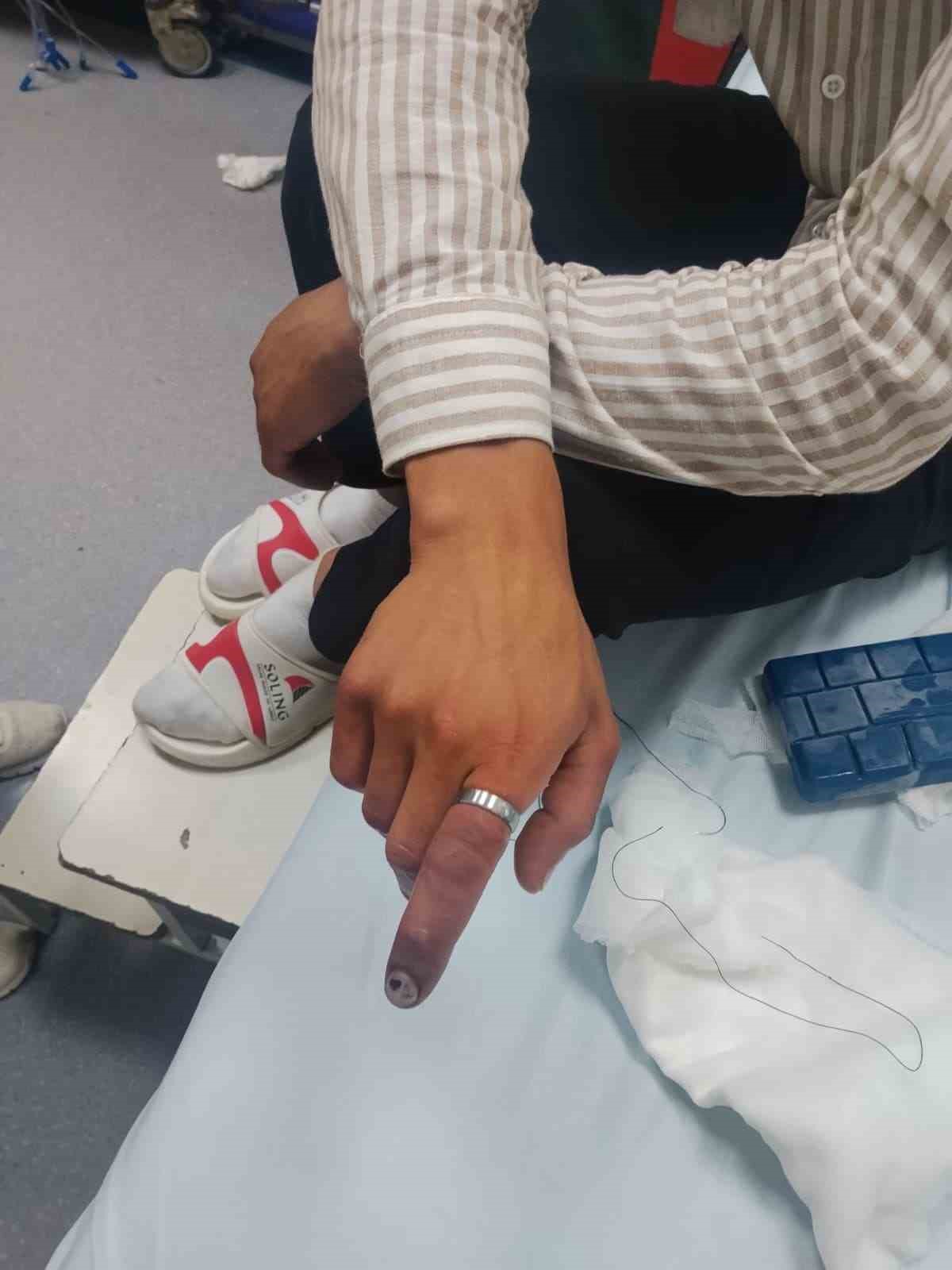 PARMAĞINDA SIKIŞAN YÜZÜK İTFAİYE EKİPLERİNCE KESİLDİ