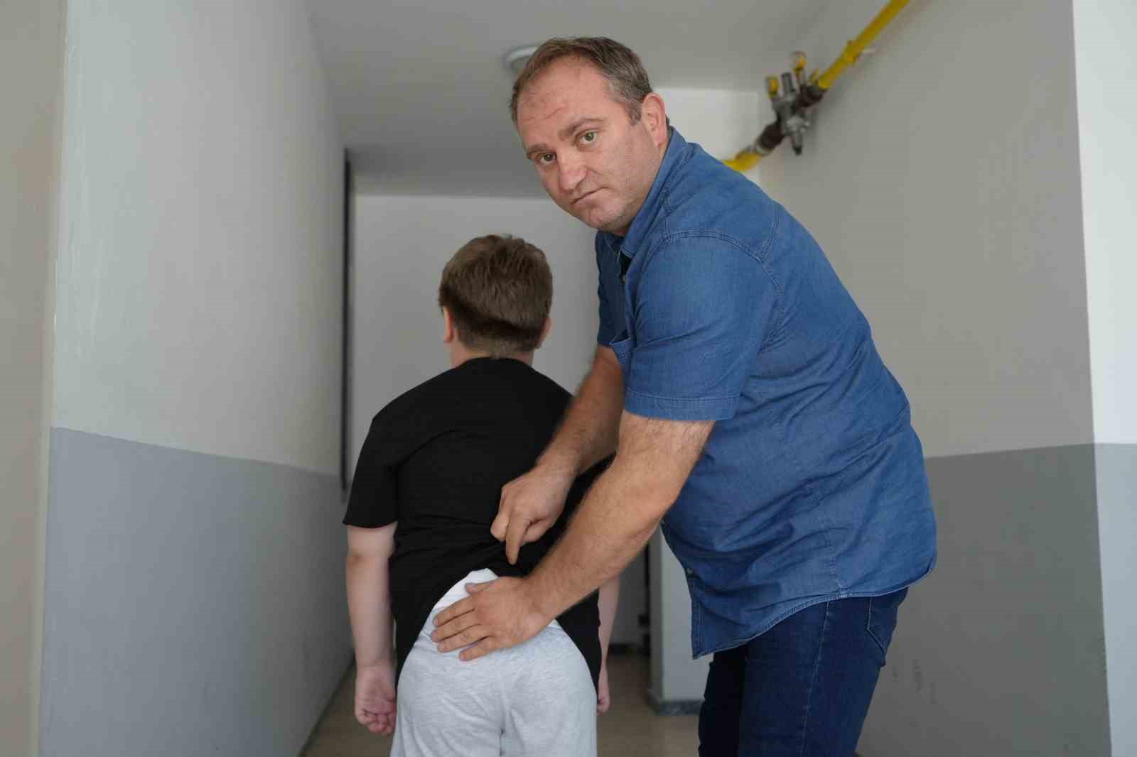 BOLU’DA BELÇİKA KURDU ÇOCUĞU KALÇASINDAN ISIRDI, SAHİBİNİN SÖZLERİ PES DEDİRTTİ
