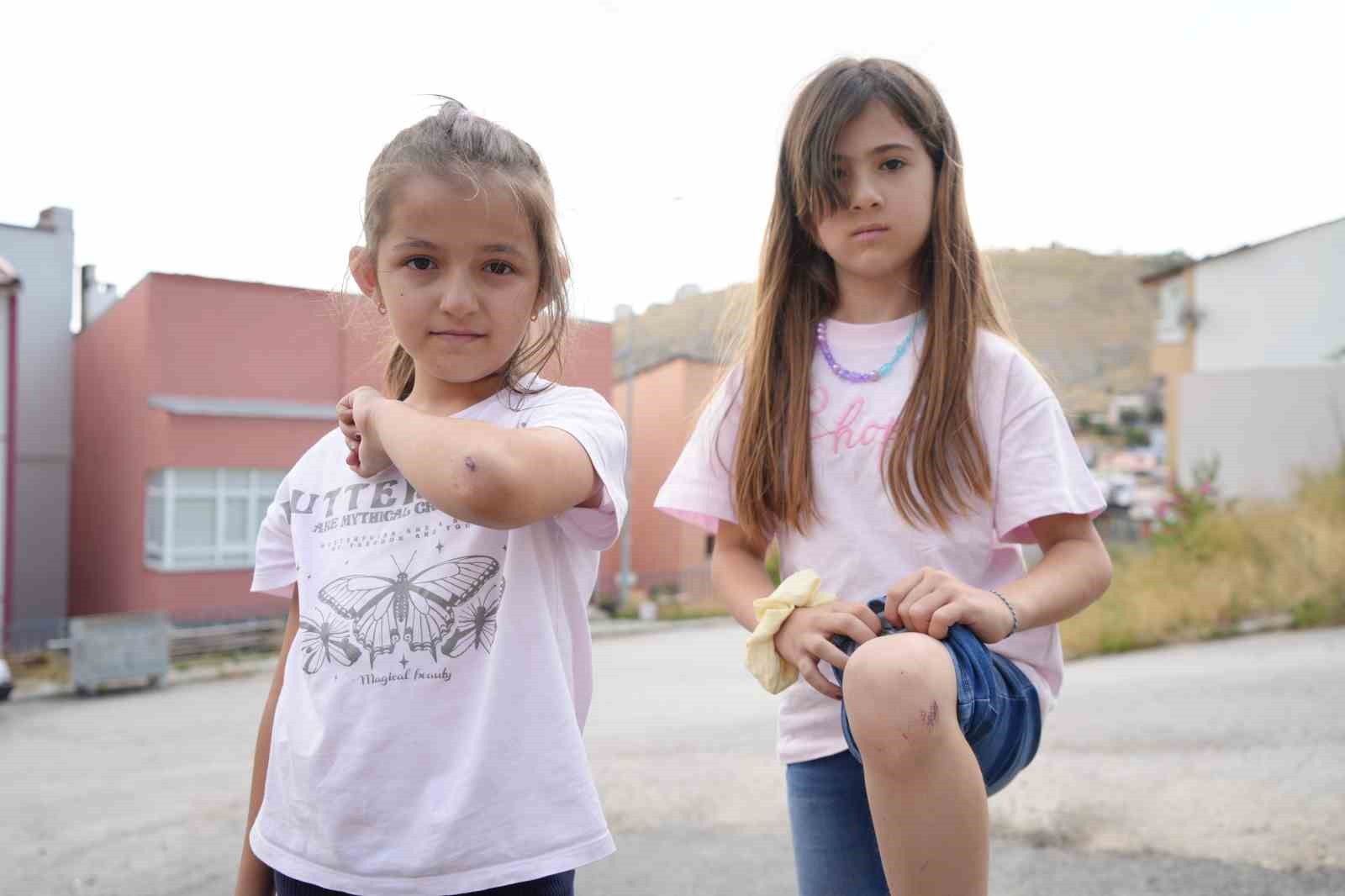 BAYBURT’A TATİLE GELEN İKİ KUZEN KÖPEKLERDEN KAÇARKEN YARALANDI