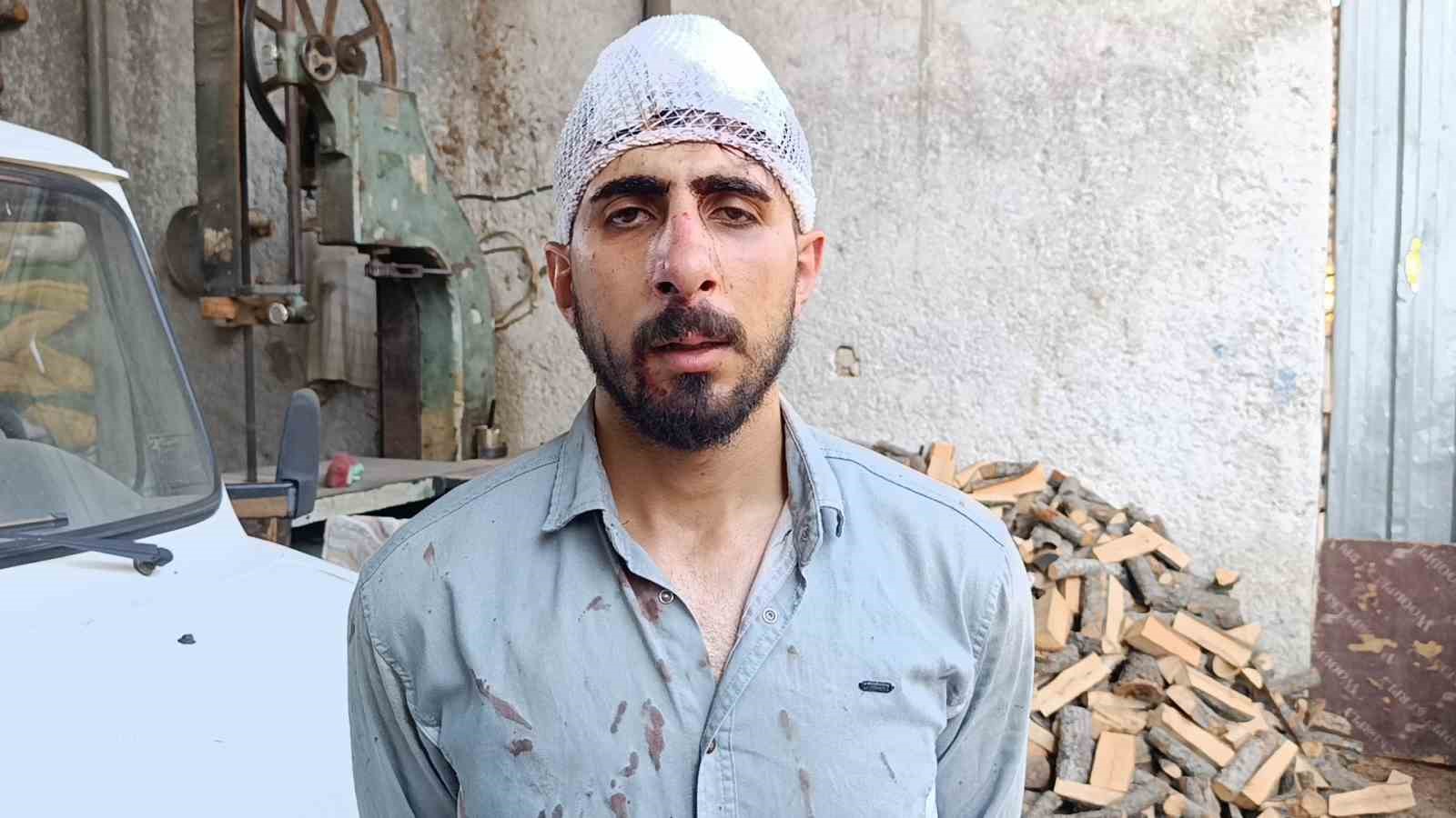 ŞANLIURFA’DA TRAFİKTE YAVAŞ GİDEN SÜRÜCÜYE MEYDAN DAYAĞI: BURNU KIRILDI, BAŞINA 8 DİKİŞ ATILDI