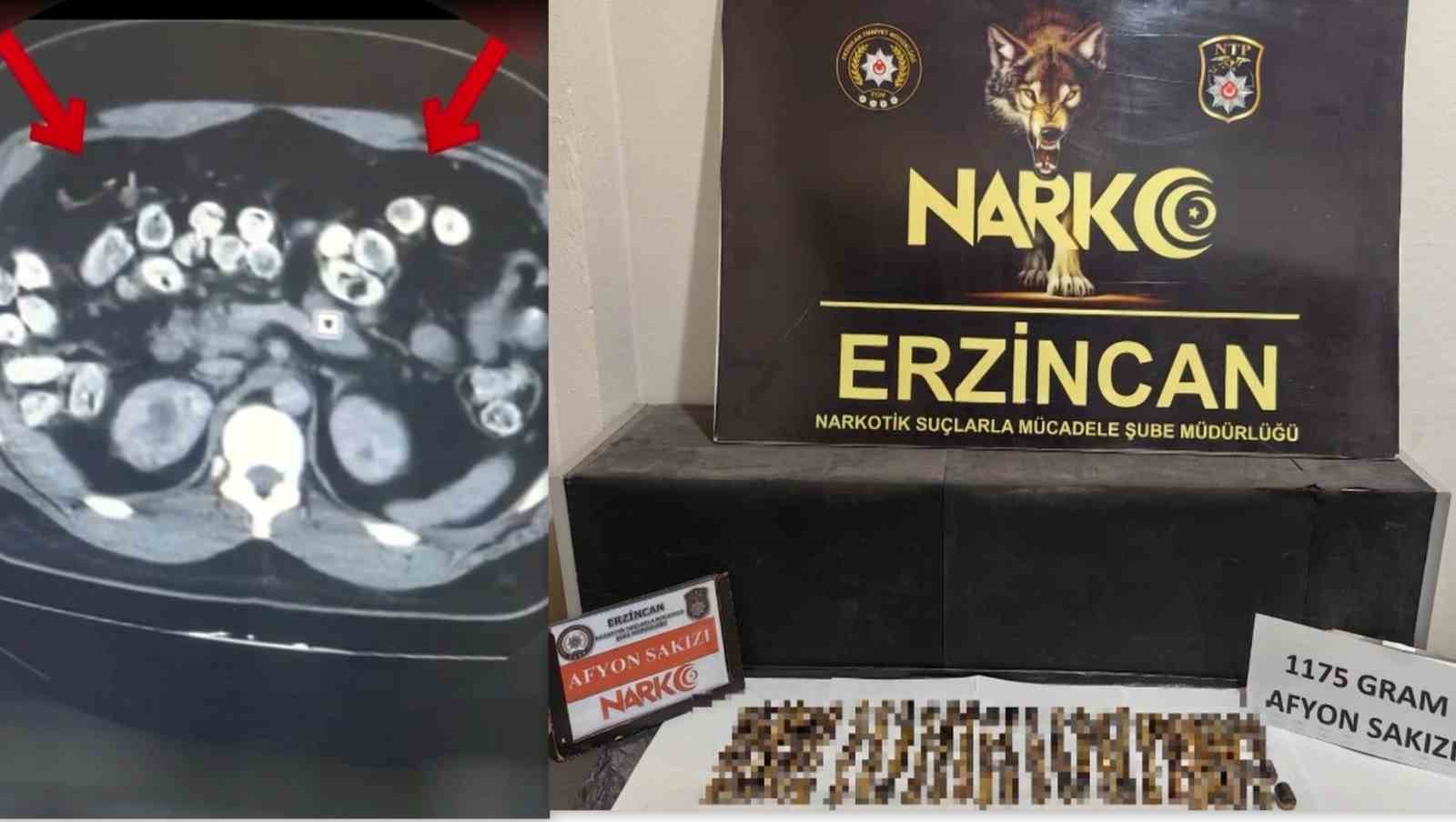 ERZİNCAN’DA UYUŞTURUCUYU VÜCUTLARINDA TAŞIYAN 3 ŞÜPHELİ YAKALANDI