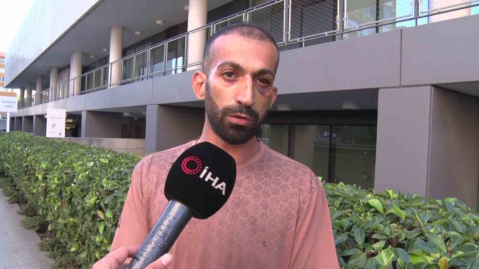 GAZİOSMANPAŞA’DA TACİZ İDDİASIYLA DARBEDİLEN ŞAHIS KONUŞTU