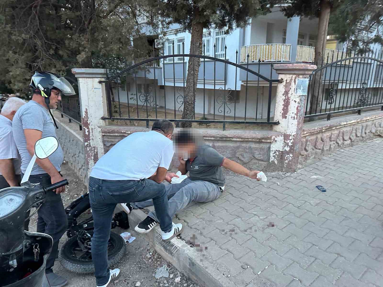 ELEKTRİKLİ BİSİKLET DUVARA ÇARPTI: 1 YARALI